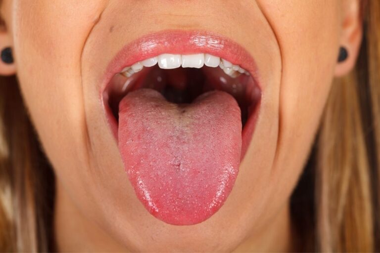 Manchas rojas en la lengua