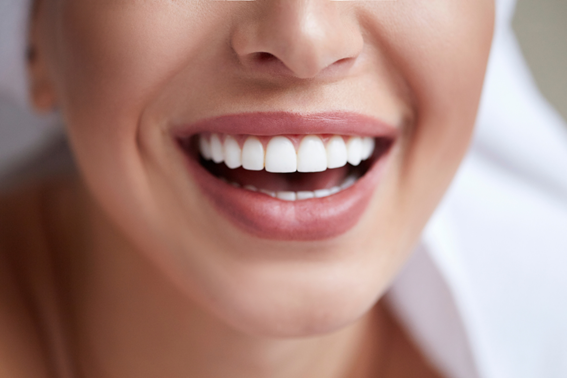 Consejos para que el blanqueamiento dental te dure el máximo tiempo posible